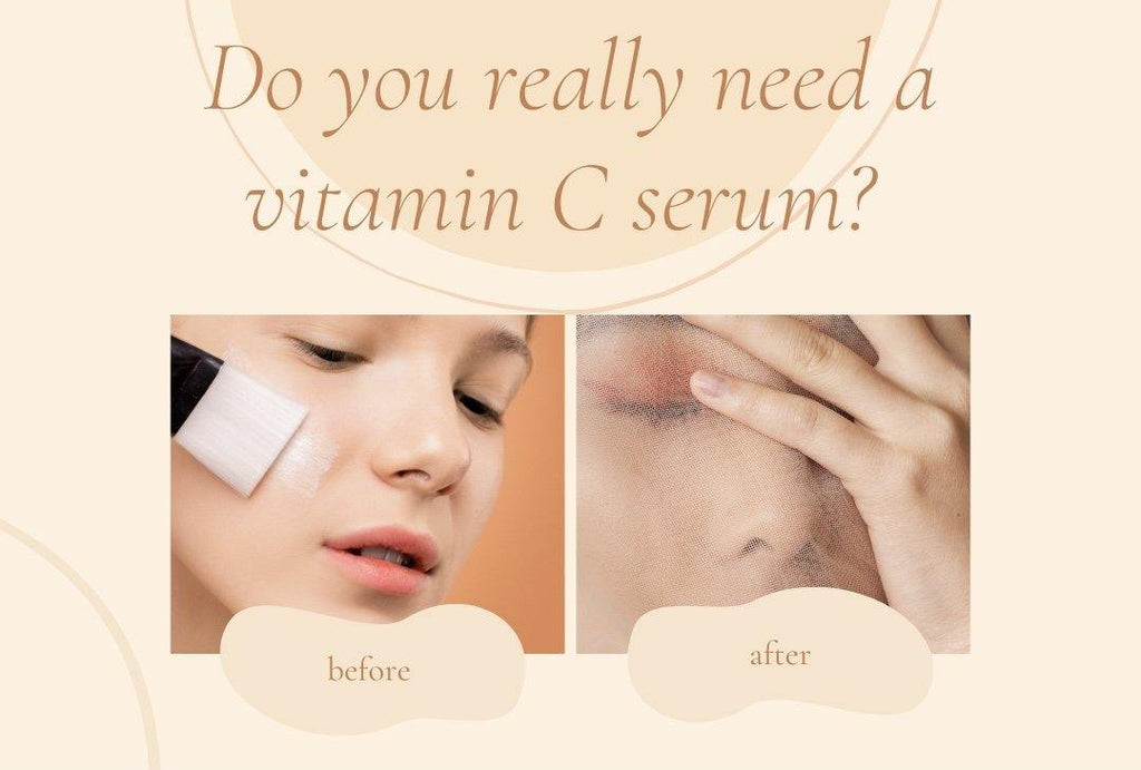 Do You Really Need a Vitamin C Serum? - HelloSkin